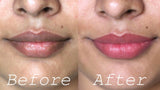 Before and after lip cleansing results