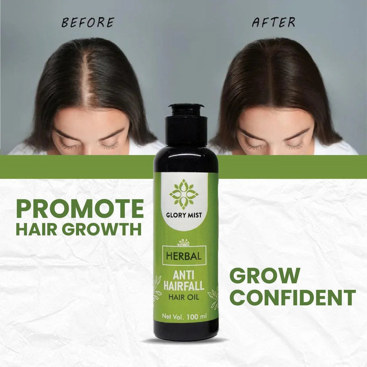 💆 Glory Mist Anti-Hairfall Oil - Glory Mist